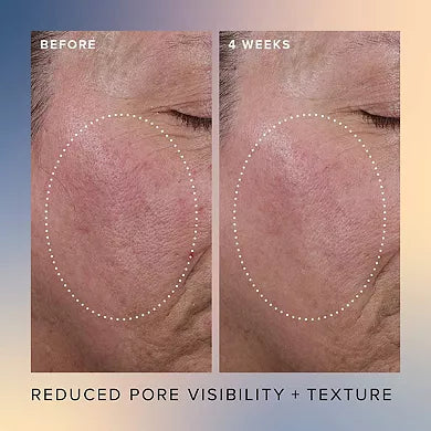 Farmacy Honey Glow 17% AHA + BHA Resurfacing Acid Serum