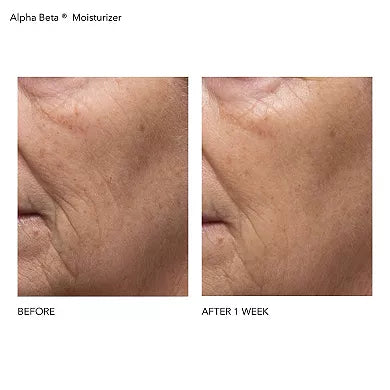 Dr. Dennis Gross Skincare Alpha Beta Daily Moisturizer