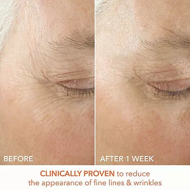 Dr. Dennis Gross Skincare Mini Alpha Beta Ultra Gentle Daily Peel Pads para Piel Sensible 5ct