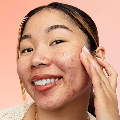 Peace Out 2% Salicylic Acid Acne Gel Moisturizer