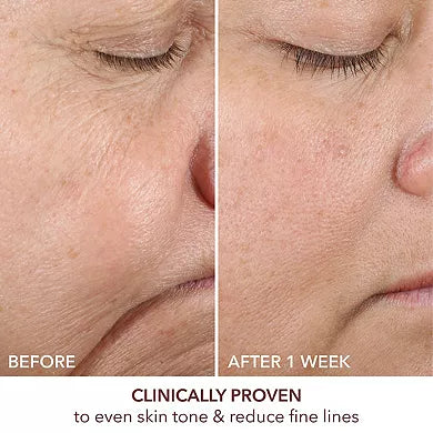 Dr. Dennis Gross Skincare Advanced Retinol + Ferulic Texture Renewal Serum