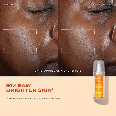 Murad Suero Corrector Rápido de Manchas con Ácido Glicólico y Tranexámico .33 FL OZ