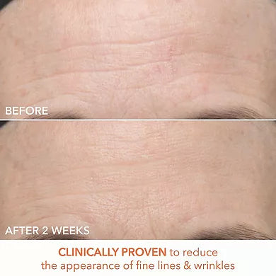 Dr. Dennis Gross Skincare Mini Alpha Beta Ultra Gentle Daily Peel Pads para Piel Sensible 5ct