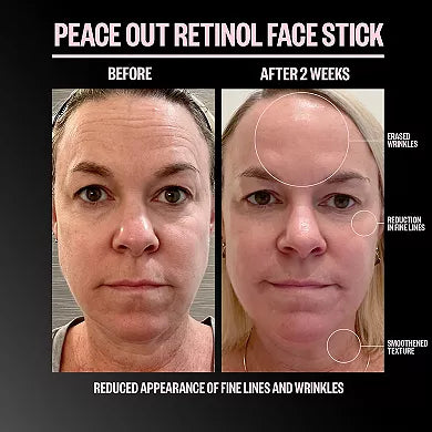 Peace Out Retinol Face Stick