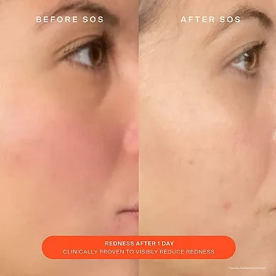 Tower 28 Beauty SOS Daily Skin Barrier Redness Recovery Moisturizer