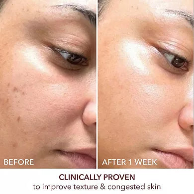 Dr. Dennis Gross Skincare Advanced Retinol + Ferulic Texture Renewal Serum