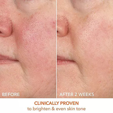 Dr. Dennis Gross Skincare Sérum Vitamina C Láctico 15% Reafirmante e Iluminador