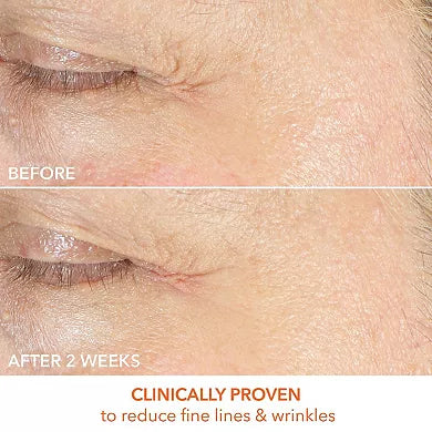 Dr. Dennis Gross Skincare Vitamin C Lactic Firm & Bright Eye Treatment