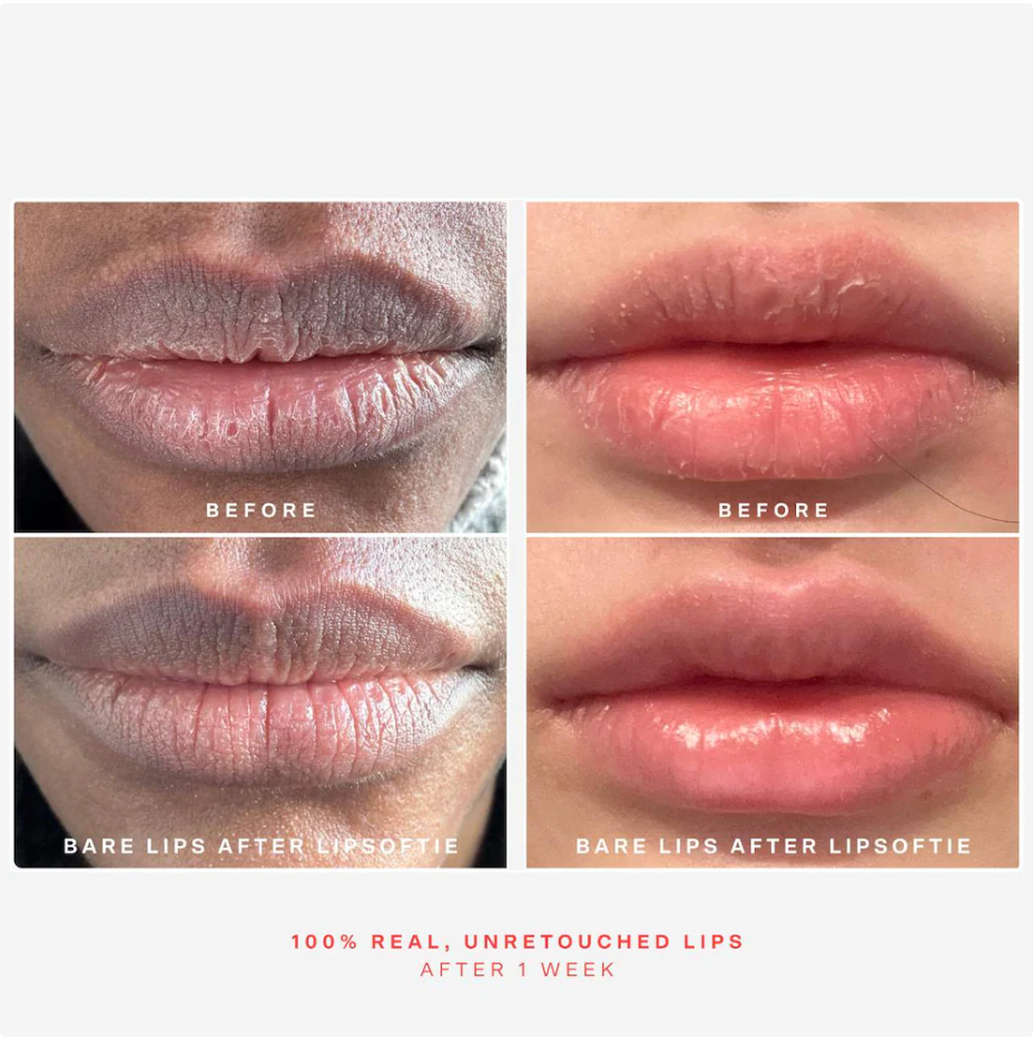 Tower 28 Beauty SOS LipSoftie® Bálsamo Labial Hidratante de Tratamiento