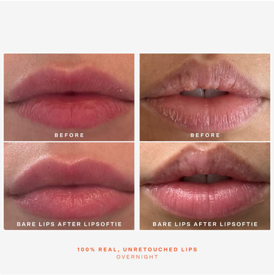 Tower 28 Beauty SOS LipSoftie® Bálsamo Labial Hidratante de Tratamiento