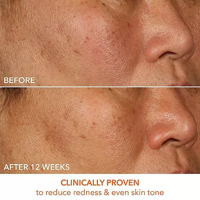 Dr. Dennis Gross Skincare Sérum Vitamina C Láctico 15% Reafirmante e Iluminador