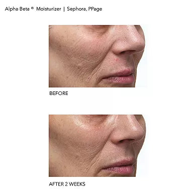 Dr. Dennis Gross Skincare Alpha Beta Daily Moisturizer