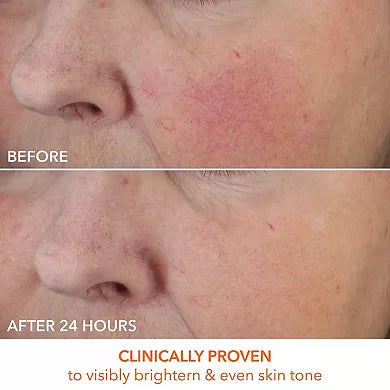 Dr. Dennis Gross Skincare Vitamin C Lactic Dewy Deep Cream