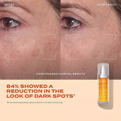 Murad Suero Corrector Rápido de Manchas con Ácido Glicólico y Tranexámico .33 FL OZ