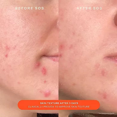 Tower 28 Beauty SOS Daily Skin Barrier Redness Recovery Moisturizer