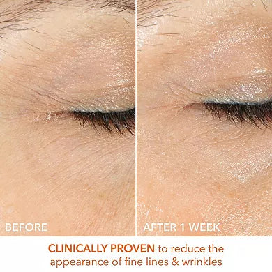 Dr. Dennis Gross Skincare Vitamin C Lactic Firm & Bright Eye Treatment