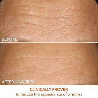 Dr. Dennis Gross Skincare Sérum Vitamina C Láctico 15% Reafirmante e Iluminador