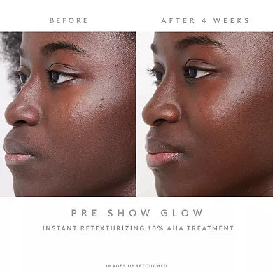 Fenty Skin Pre-Show Glow Tratamiento Reutilizable Instantáneo de Retexturización con 10% AHA