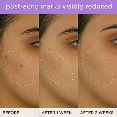 Tatcha Sérum Iluminador y Reafirmante con Vitamina C y Ácido Ferúlico