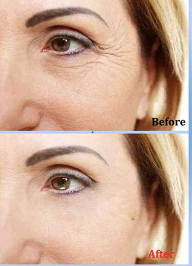 Paquete de 30 Pares Mascarillas De Ojos Eye Patch Anti Arrugas Oro